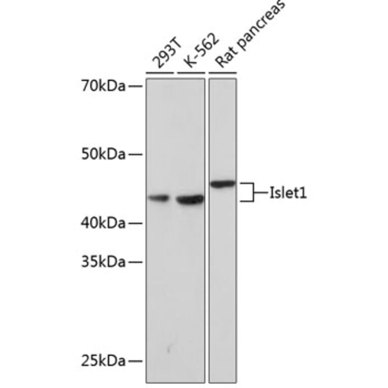 Western Blot - Anti-Islet 1 Antibody [ARC0511] (A309185) - Antibodies.com