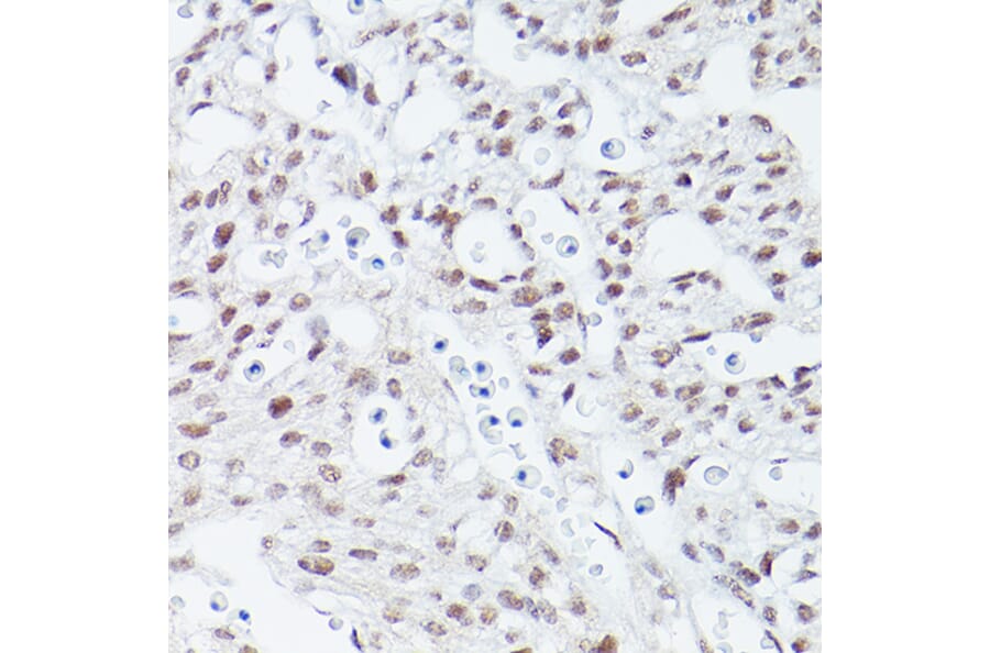 Immunohistochemistry - Anti-Islet 1 Antibody [ARC0511] (A309185) - Antibodies.com