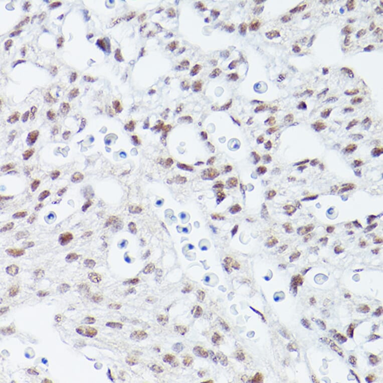 Immunohistochemistry - Anti-Islet 1 Antibody [ARC0511] (A309185) - Antibodies.com