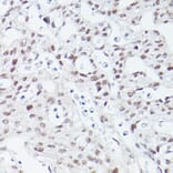 Immunohistochemistry - Anti-Islet 1 Antibody [ARC0511] (A309185) - Antibodies.com