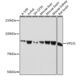 Western Blot - Anti-VPS35 Antibody [ARC1509] (A309186) - Antibodies.com