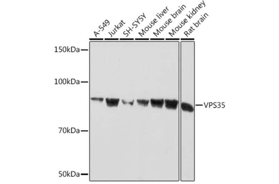 Western Blot - Anti-VPS35 Antibody [ARC1509] (A309186) - Antibodies.com
