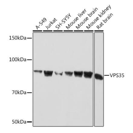 Western Blot - Anti-VPS35 Antibody [ARC1509] (A309186) - Antibodies.com