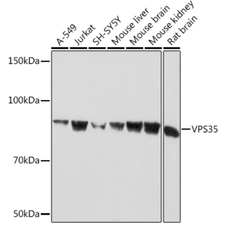 Western Blot - Anti-VPS35 Antibody [ARC1509] (A309186) - Antibodies.com