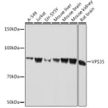 Western Blot - Anti-VPS35 Antibody [ARC1509] (A309186) - Antibodies.com