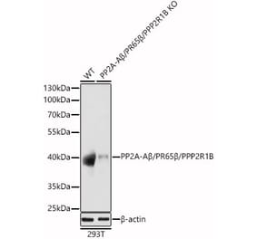 Western Blot - Anti-PPP2R1B Antibody (A309187) - Antibodies.com
