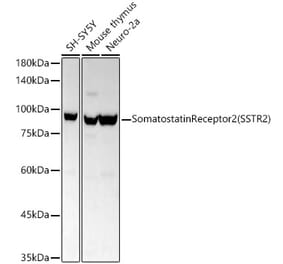 Western Blot - Anti-Somatostatin Receptor 2 Antibody [ARC54043] (A309188) - Antibodies.com