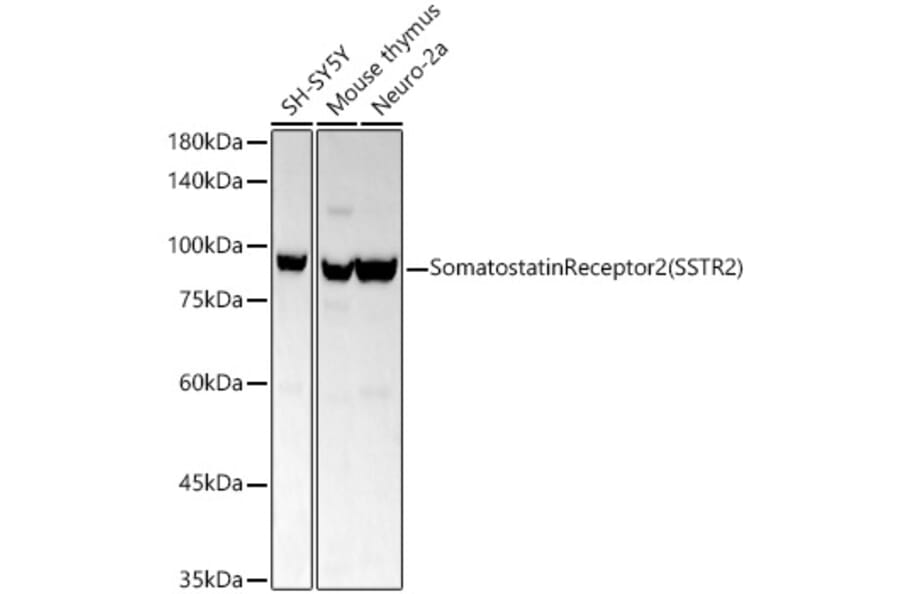 Western Blot - Anti-Somatostatin Receptor 2 Antibody [ARC54043] (A309188) - Antibodies.com