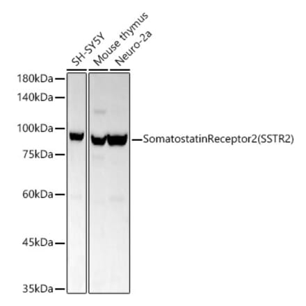 Western Blot - Anti-Somatostatin Receptor 2 Antibody [ARC54043] (A309188) - Antibodies.com