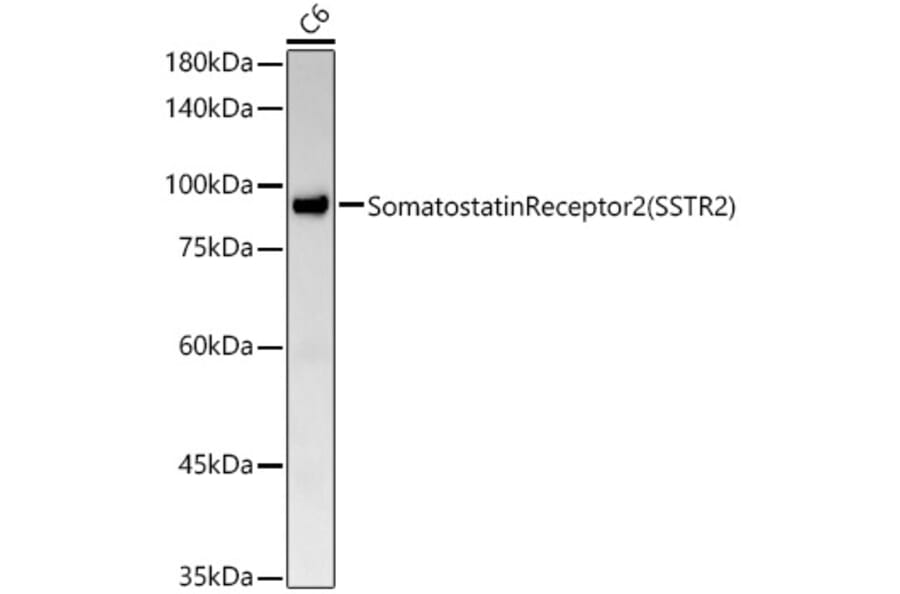 Western Blot - Anti-Somatostatin Receptor 2 Antibody [ARC54043] (A309188) - Antibodies.com