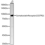 Western Blot - Anti-Somatostatin Receptor 2 Antibody [ARC54043] (A309188) - Antibodies.com