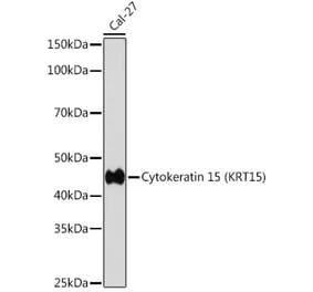 Western Blot - Anti-Cytokeratin 15 Antibody [ARC0270] (A309189) - Antibodies.com