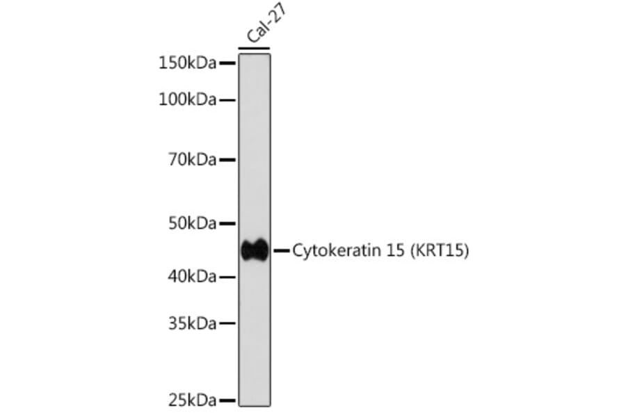 Western Blot - Anti-Cytokeratin 15 Antibody [ARC0270] (A309189) - Antibodies.com