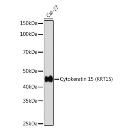 Western Blot - Anti-Cytokeratin 15 Antibody [ARC0270] (A309189) - Antibodies.com
