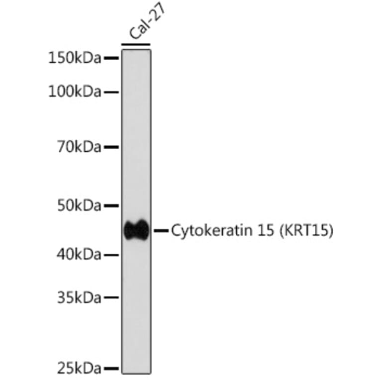 Western Blot - Anti-Cytokeratin 15 Antibody [ARC0270] (A309189) - Antibodies.com