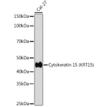 Western Blot - Anti-Cytokeratin 15 Antibody [ARC0270] (A309189) - Antibodies.com