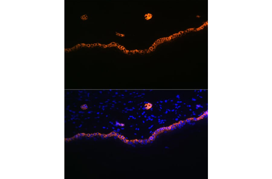 Immunofluorescence - Anti-Cytokeratin 15 Antibody [ARC0270] (A309189) - Antibodies.com