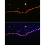 Immunofluorescence - Anti-Cytokeratin 15 Antibody [ARC0270] (A309189) - Antibodies.com