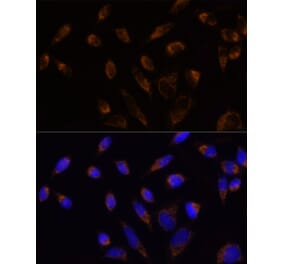 Immunofluorescence - Anti-TOMM20 Antibody (A309190) - Antibodies.com