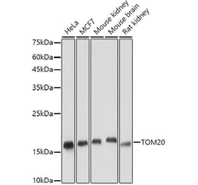 Western Blot - Anti-TOMM20 Antibody [ARC5002-01] (A309191) - Antibodies.com