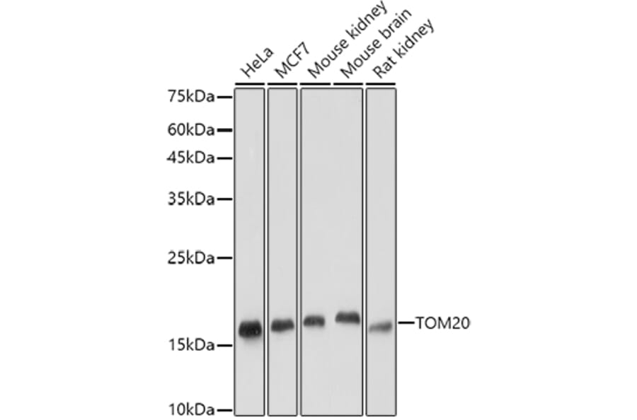 Western Blot - Anti-TOMM20 Antibody [ARC5002-01] (A309191) - Antibodies.com