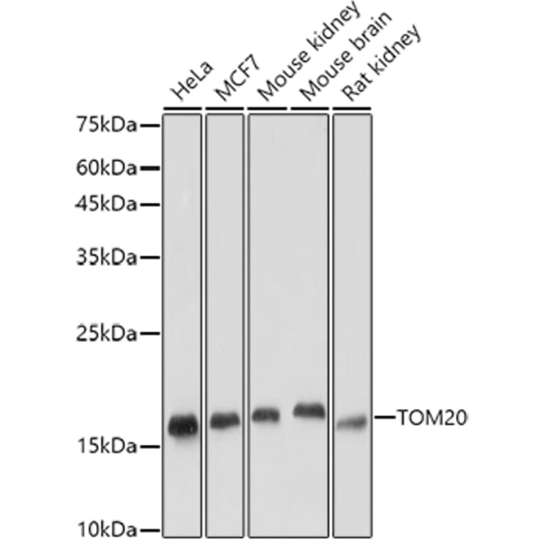 Western Blot - Anti-TOMM20 Antibody [ARC5002-01] (A309191) - Antibodies.com