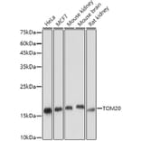 Western Blot - Anti-TOMM20 Antibody [ARC5002-01] (A309191) - Antibodies.com