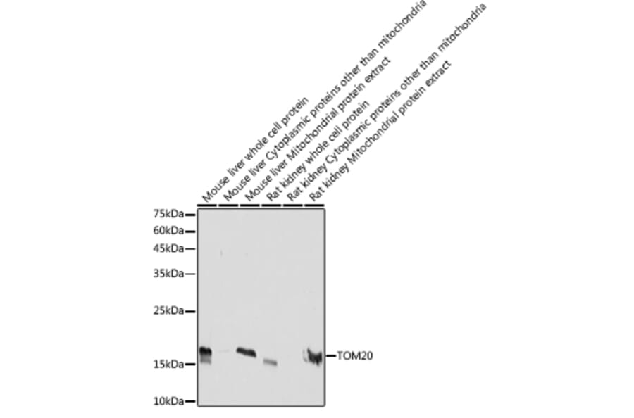 Western Blot - Anti-TOMM20 Antibody [ARC5002-01] (A309191) - Antibodies.com