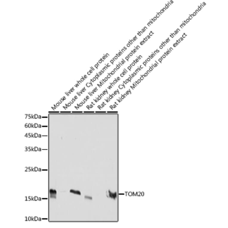 Western Blot - Anti-TOMM20 Antibody [ARC5002-01] (A309191) - Antibodies.com
