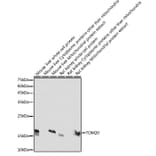 Western Blot - Anti-TOMM20 Antibody [ARC5002-01] (A309191) - Antibodies.com