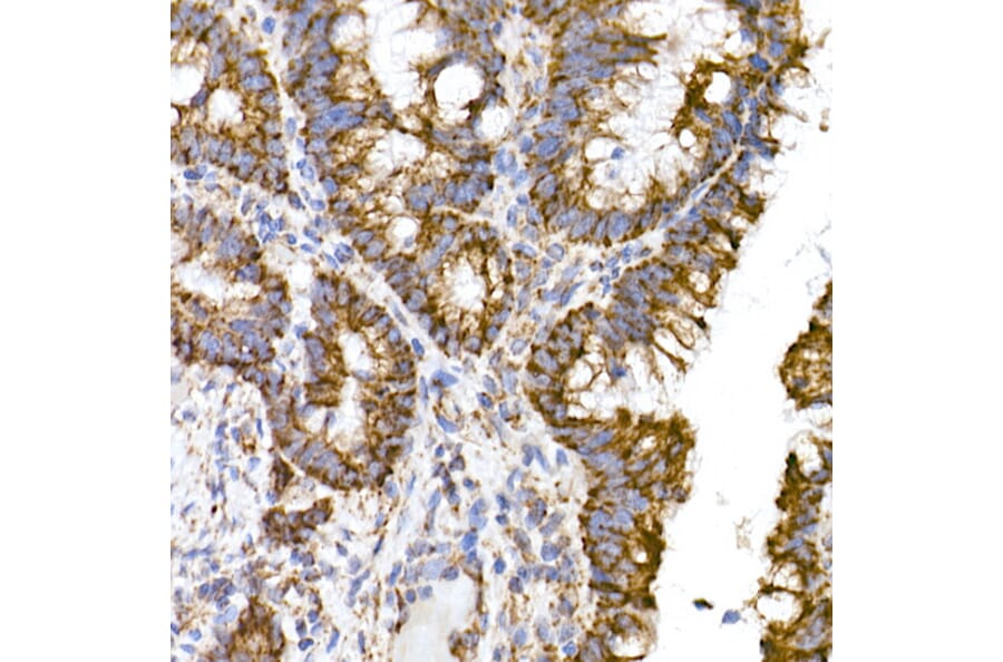 Immunohistochemistry - Anti-TOMM20 Antibody [ARC5002-01] (A309191) - Antibodies.com