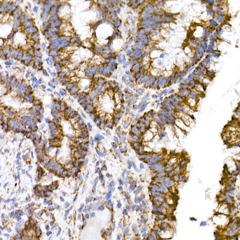Immunohistochemistry - Anti-TOMM20 Antibody [ARC5002-01] (A309191) - Antibodies.com