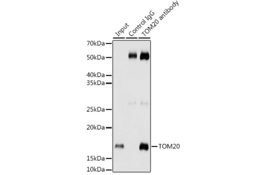 Western Blot - Anti-TOMM20 Antibody [ARC5002-01] (A309191) - Antibodies.com