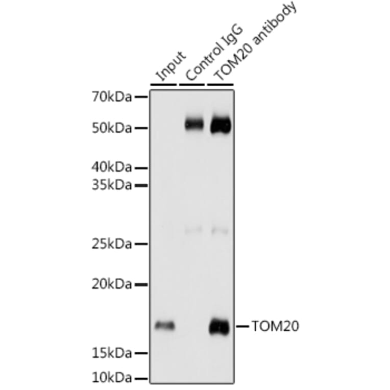 Western Blot - Anti-TOMM20 Antibody [ARC5002-01] (A309191) - Antibodies.com
