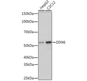 Western Blot - Anti-DDX6 Antibody [ARC1673] (A309192) - Antibodies.com