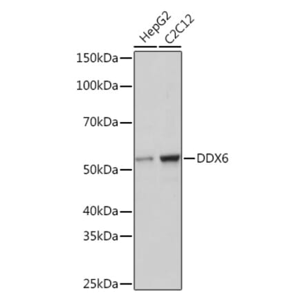 Western Blot - Anti-DDX6 Antibody [ARC1673] (A309192) - Antibodies.com