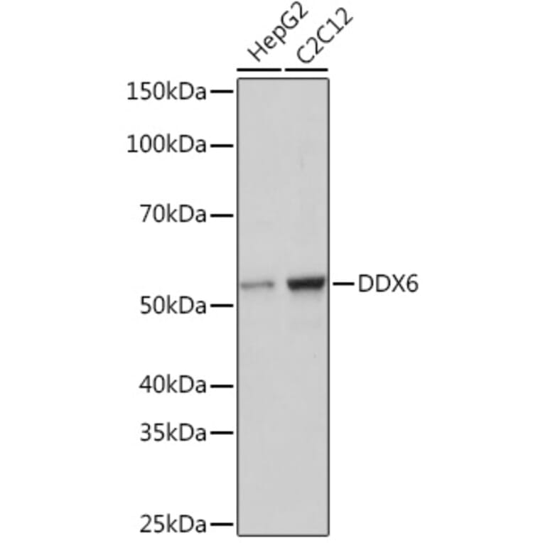 Western Blot - Anti-DDX6 Antibody [ARC1673] (A309192) - Antibodies.com