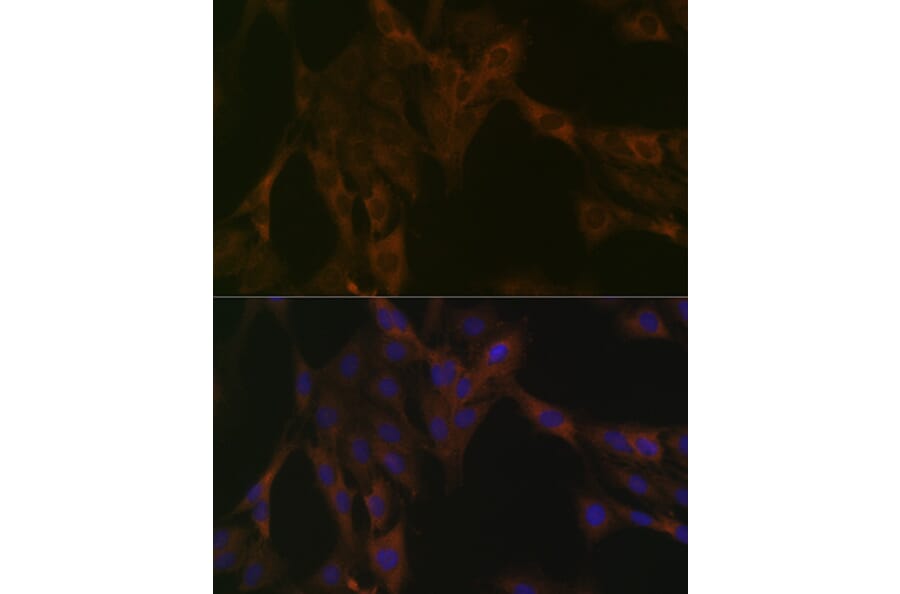 Immunofluorescence - Anti-DDX6 Antibody [ARC1673] (A309192) - Antibodies.com