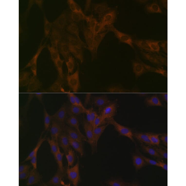 Immunofluorescence - Anti-DDX6 Antibody [ARC1673] (A309192) - Antibodies.com