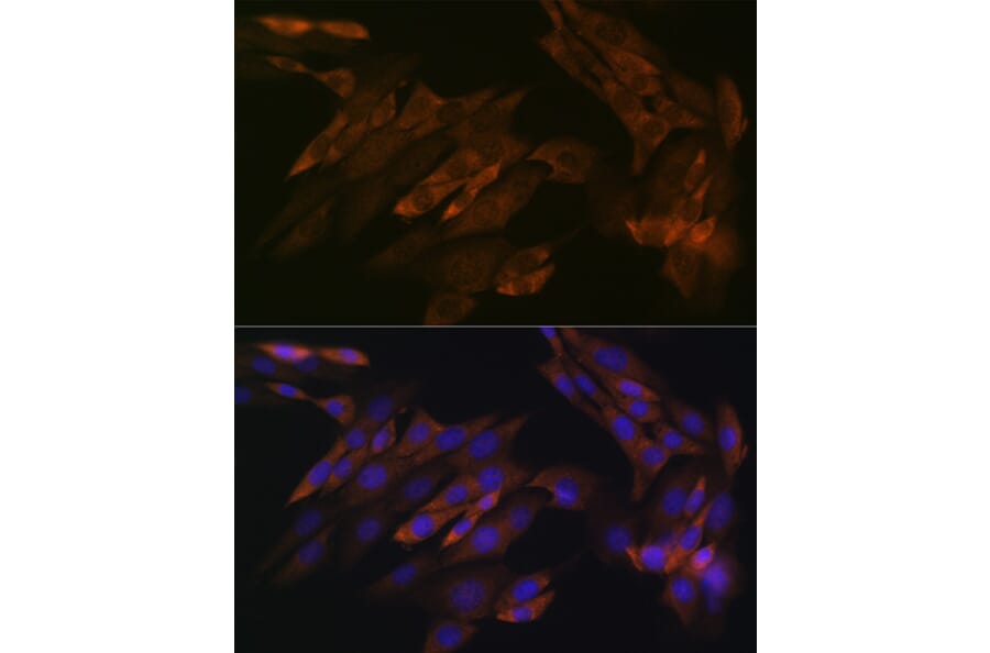 Immunofluorescence - Anti-DDX6 Antibody [ARC1673] (A309192) - Antibodies.com