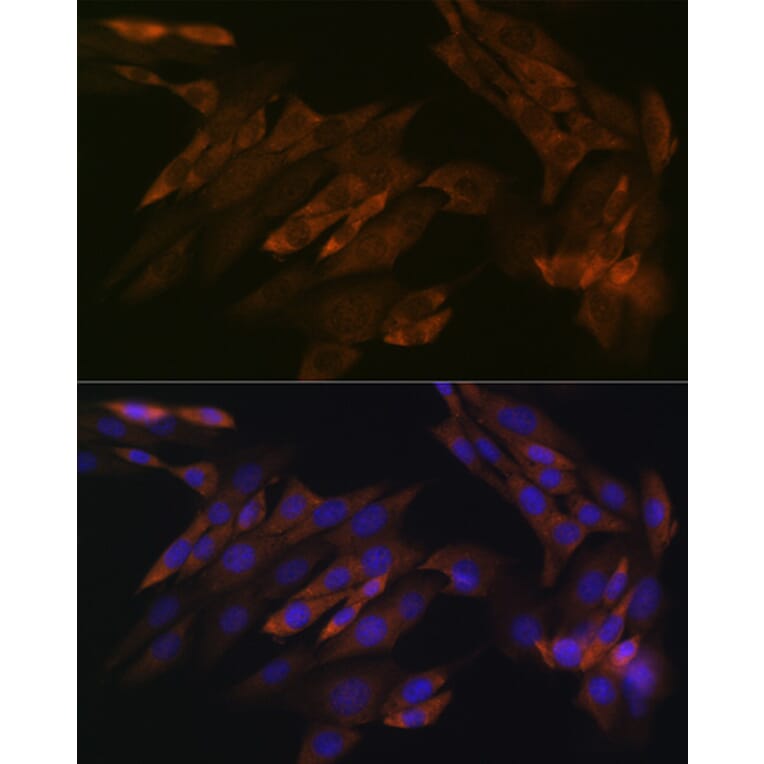 Immunofluorescence - Anti-DDX6 Antibody [ARC1673] (A309192) - Antibodies.com