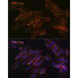 Immunofluorescence - Anti-DDX6 Antibody [ARC1673] (A309192) - Antibodies.com