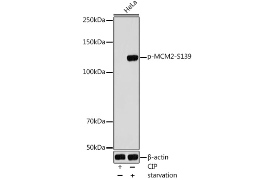 Western Blot - Anti-MCM2 (phospho Ser139) Antibody (A309197) - Antibodies.com
