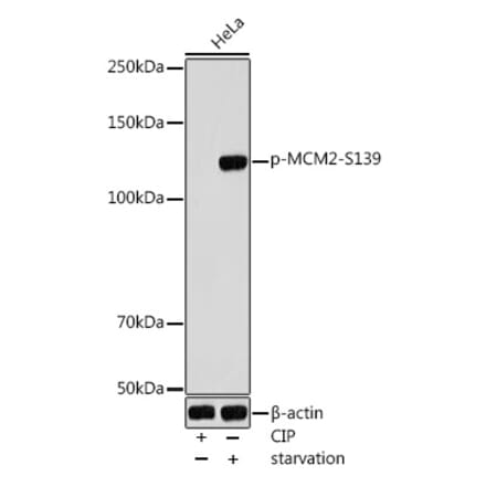 Western Blot - Anti-MCM2 (phospho Ser139) Antibody (A309197) - Antibodies.com