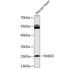 Western Blot - Anti-Rab20 Antibody (A309198) - Antibodies.com