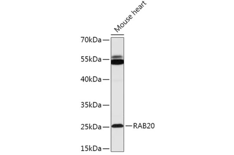 Western Blot - Anti-Rab20 Antibody (A309198) - Antibodies.com
