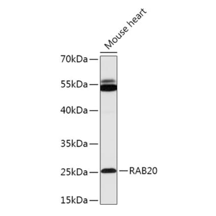 Western Blot - Anti-Rab20 Antibody (A309198) - Antibodies.com