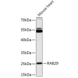 Western Blot - Anti-Rab20 Antibody (A309198) - Antibodies.com