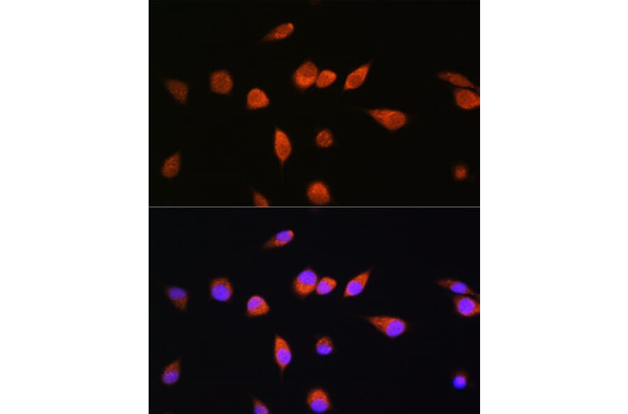 Immunofluorescence - Anti-Rab20 Antibody (A309198) - Antibodies.com