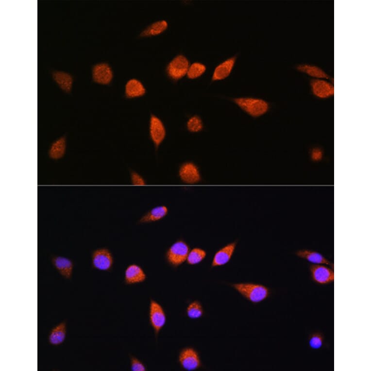 Immunofluorescence - Anti-Rab20 Antibody (A309198) - Antibodies.com